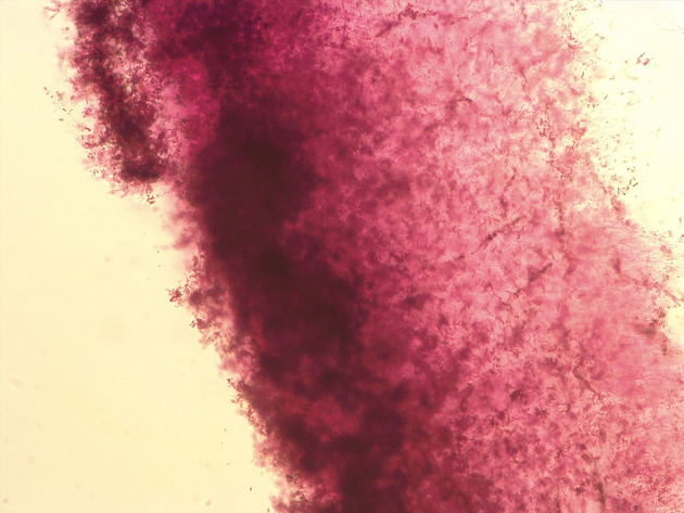 Penicillium Slides - Penicillium 01 100X